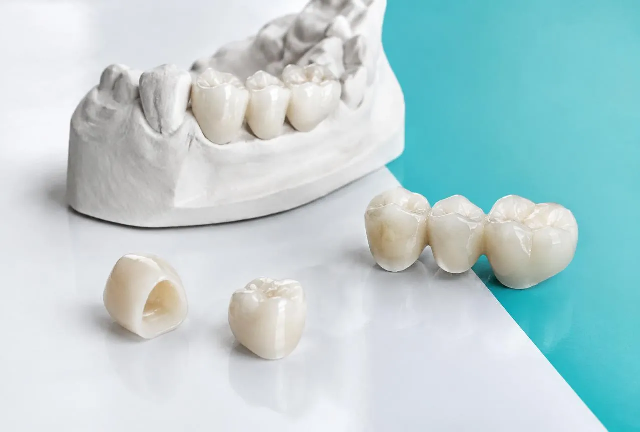 Rehabilitación oral en D7