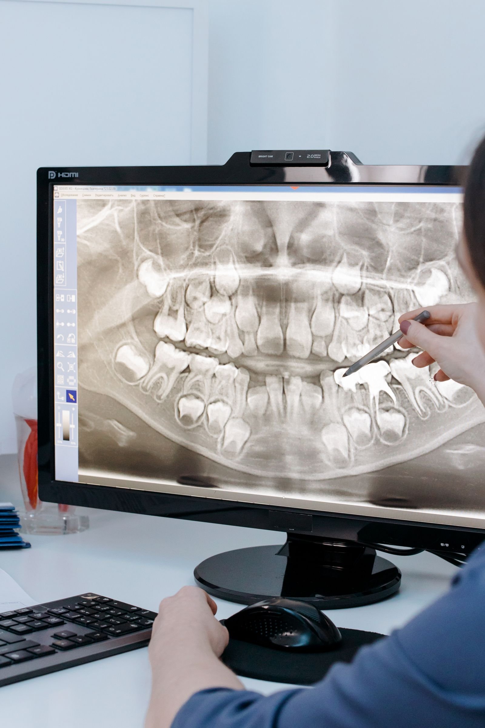 Radiografía dental en D7 Odontología